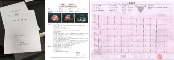 該院體檢中心的體檢報告示例 該院體檢中心的體檢報告示例